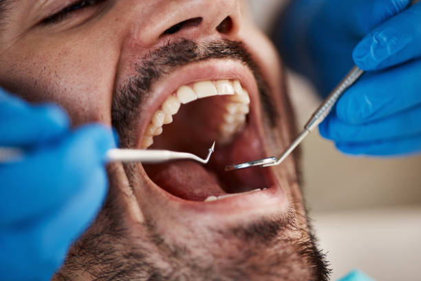 Best Emergency Treatment for Dental Infections or Abscesses in Mountain Park, GA