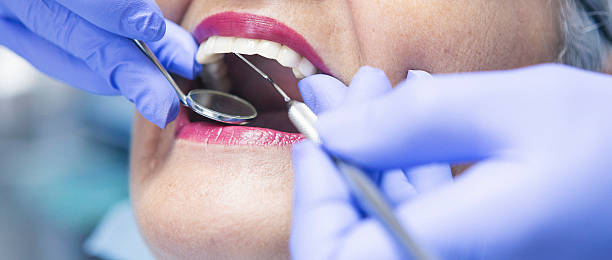 Best Emergency Tooth Extraction in Mountain Park, GA